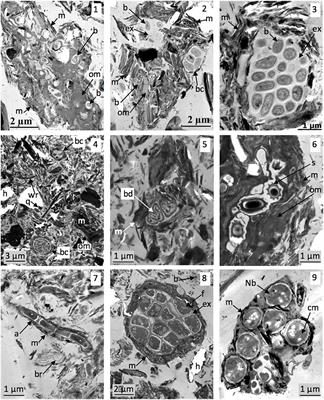 Soil Microstructures Examined Through Transmission Electron Microscopy Reveal Soil-Microorganisms Interactions